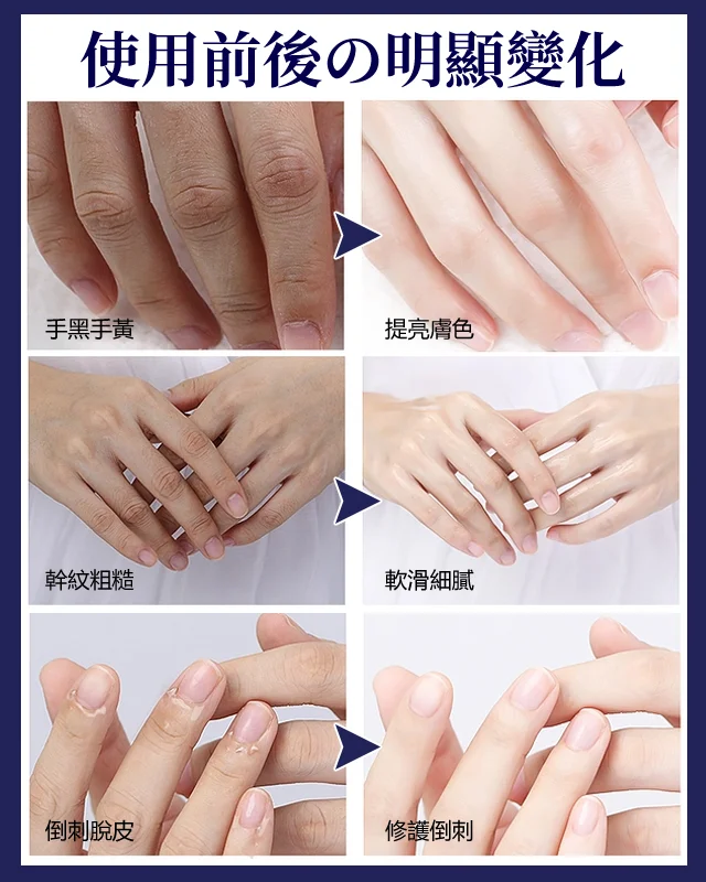 【白到發光】防乾裂美白護手霜 細嫩美白 真美白 有特證 即刻水潤嫩白,解救乾裂粗糙手! 【白到發光】防乾裂美白護手霜 細嫩美白 真美白 有特證 即刻水潤嫩白,解救乾裂粗糙手!