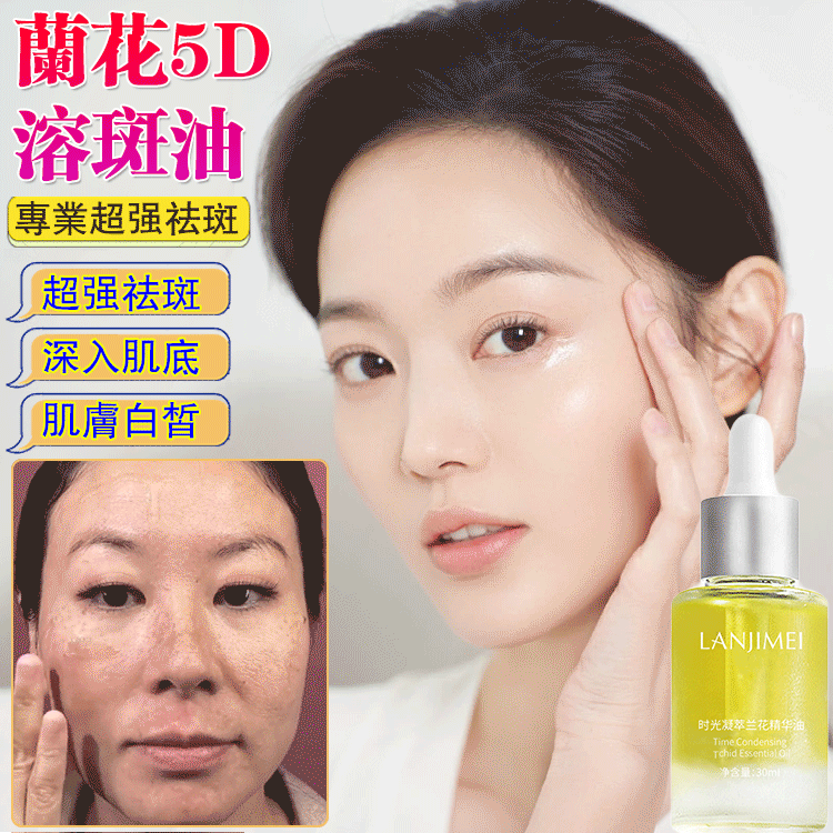 蘭花5D溶斑油 蘭花5D溶斑油